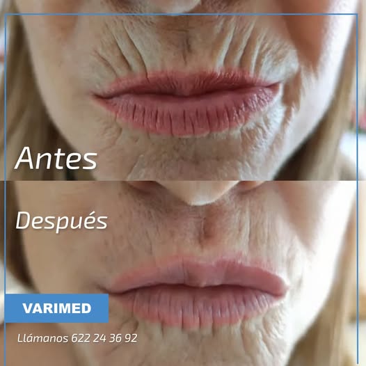 Código de barras antes y despues en Alicante